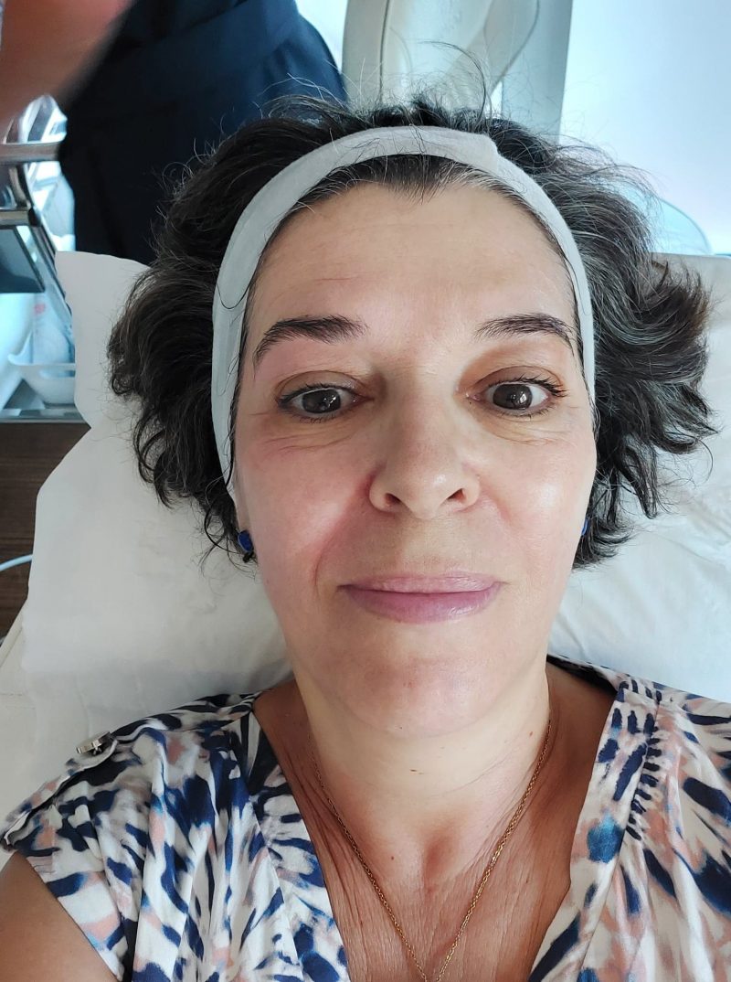 J'ai testé le soin radiofréquence Exilis Ultra 360 pour rajeunir sans chirurgie